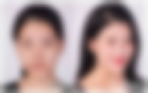 萍乡市人民医院整形美容科杨茜医生技术好不好?