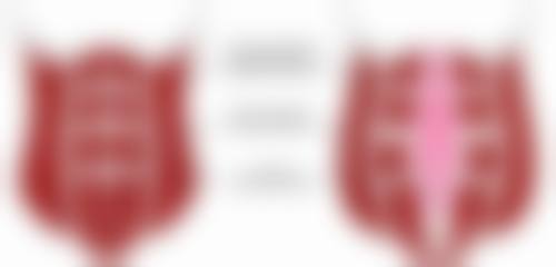 韩式隆鼻成效的维持时间