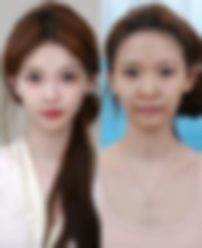 徐州美玲医学美容诊所口碑如何？
