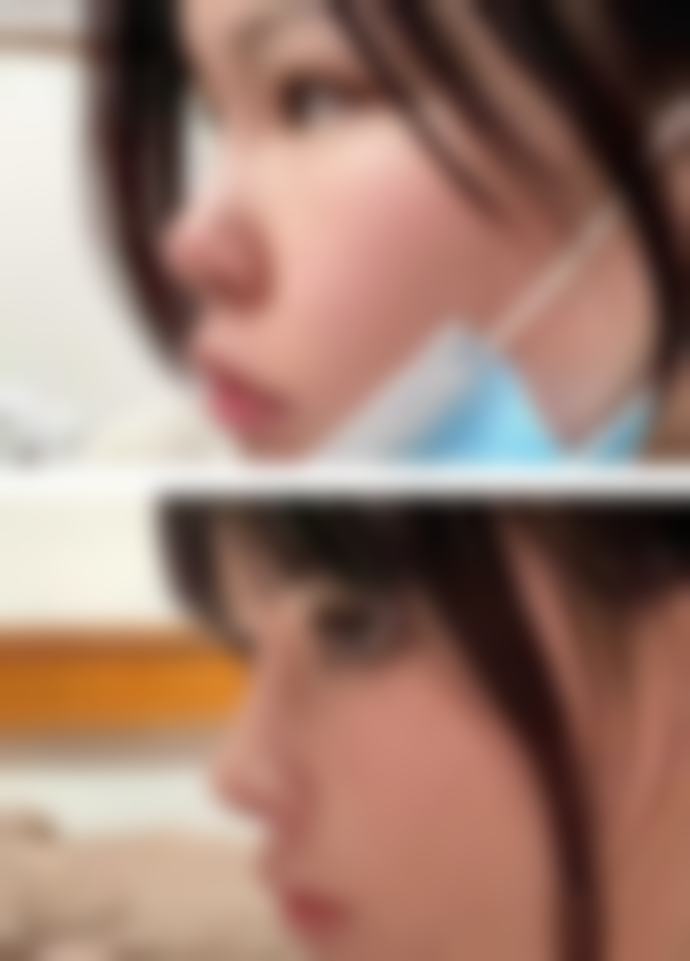 总结——山东省立医院烧伤整形科王明青医生怎么样?