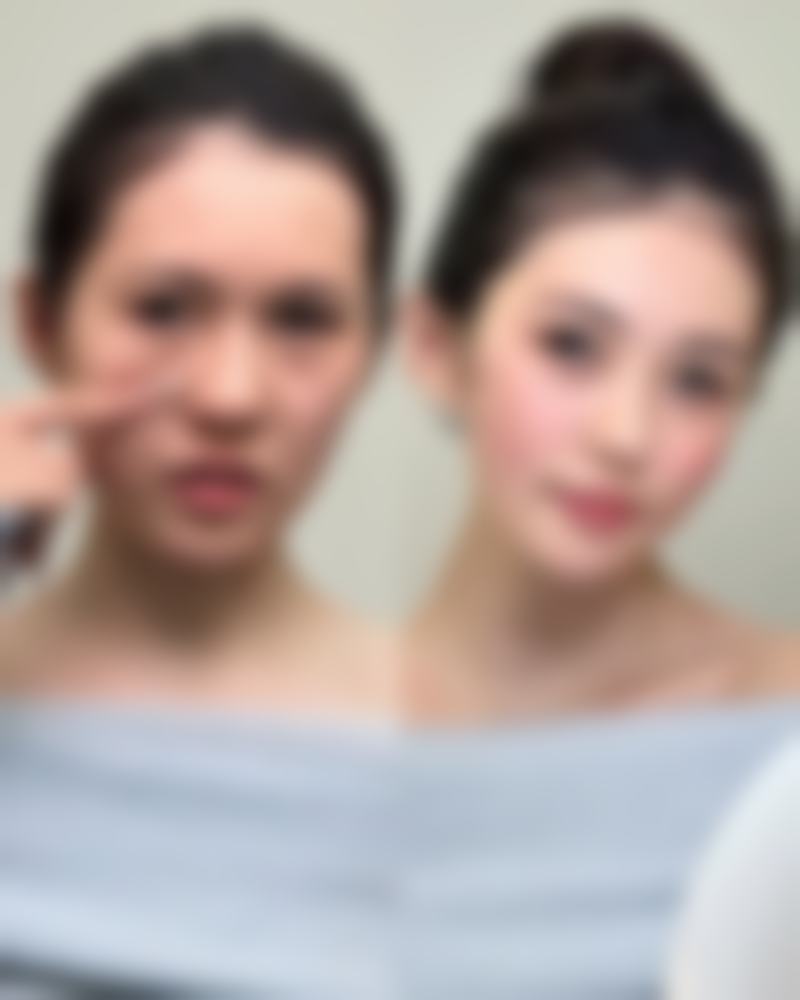 成都如悦整形医疗美容医院收费标准参考