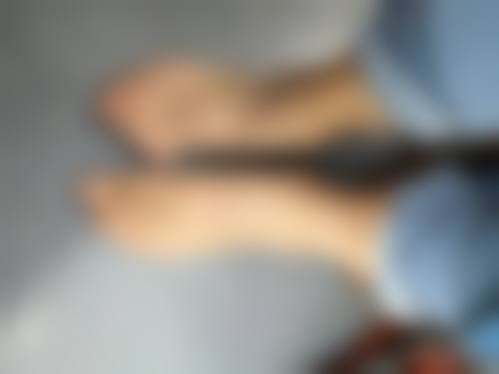 总结——毕节市第二人民医院皮肤美容科梁洁医生怎么样?