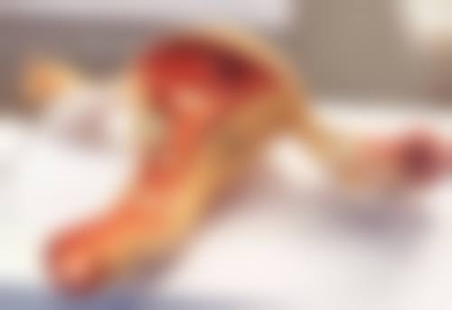手术治疗小孩烫伤疤痕
