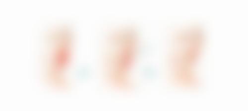 饮食不均衡引起眼袋周围发黑