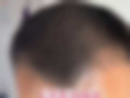 六、柳州贞韩植发医院怎么预约:
