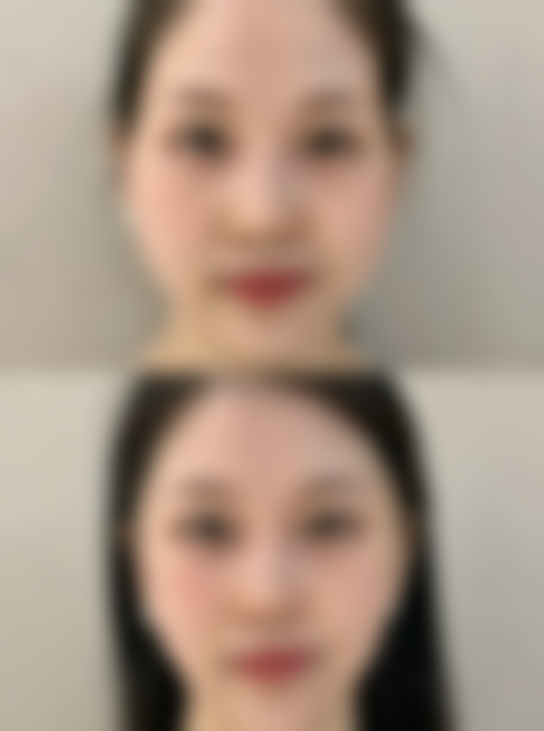 使用眼霜的正确方法