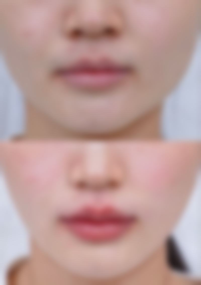 沈阳美莱整形美容医院医院技术好不好?