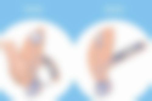 被烟头烫伤的疤痕去除之手术治疗