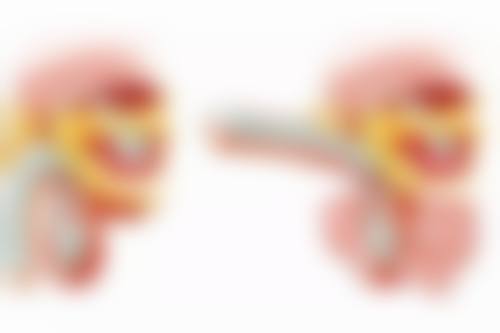 手术治疗孩子脸上的疤痕