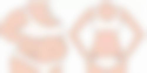 伊婉V玻尿酸