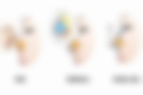 手术后吃姜伤口会留下疤痕吗？姜影响双向需综合判断，留疤还与多因素有关