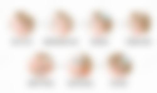 割双眼皮后眼睛肿如何快速消肿