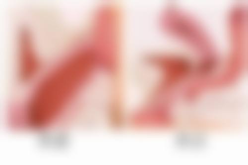 一只眼睛眼袋大是怎么回事？遗传、睡眠、年龄、过敏、肾病或成“元凶” 