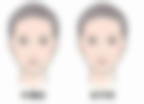 韩国hanmiin医院收费标准参考