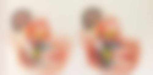 做完双眼皮要疼多久？不同术式、体质和护理下疼痛时间大不同