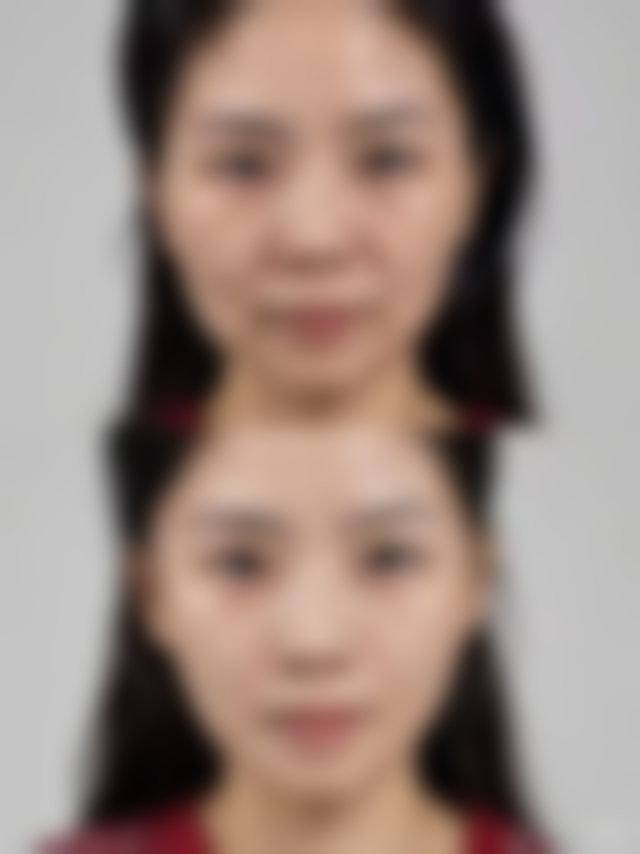 总结——佛山瑞芙臣星梦露整形医院怎么样?