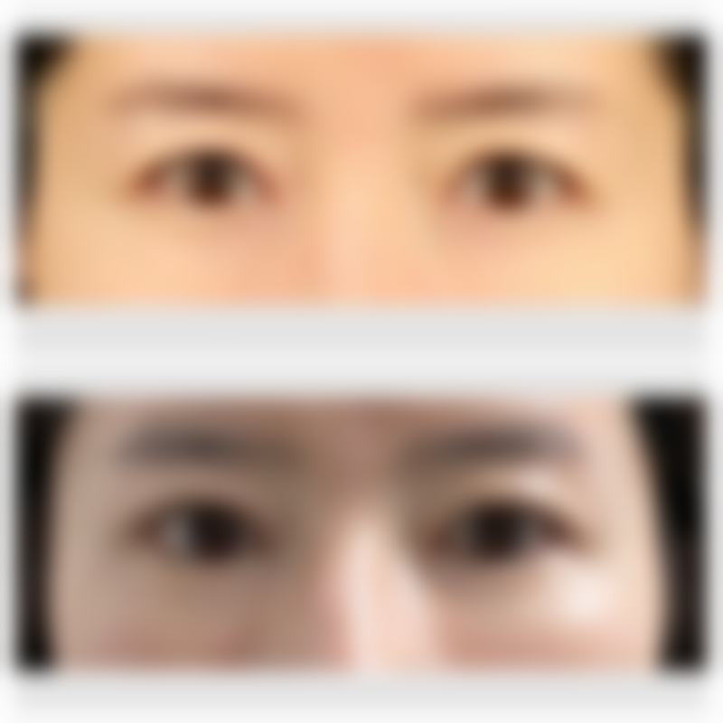 不建议一起做的原因