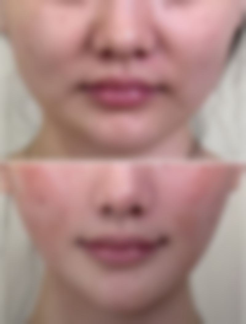 深圳美丽方案医疗美容门诊部医院技术好不好？