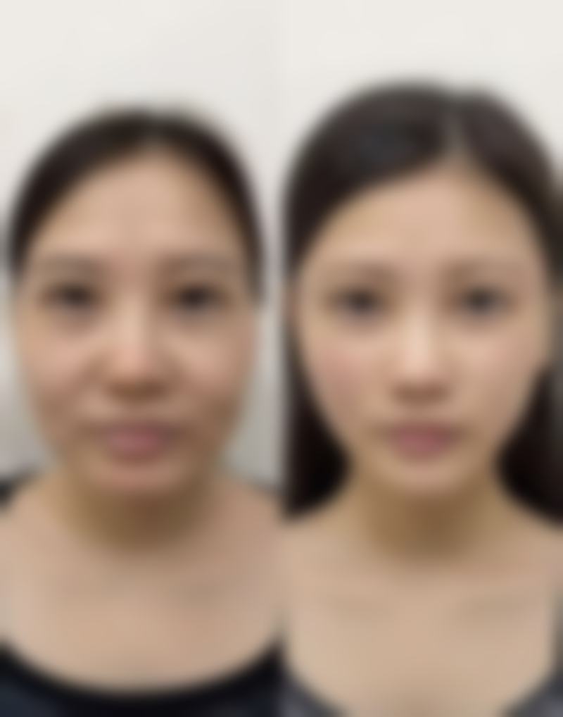 合肥西美整形张志龙医生挂号预约攻略