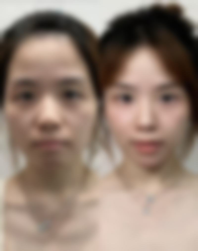 浙江杭州群英医疗美容收费标准参考