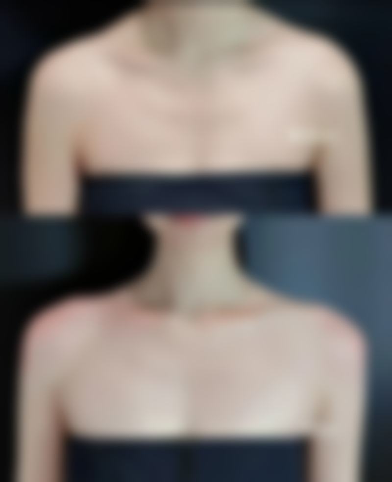 总结——福州爱而丽新医学美容门诊部怎么样？