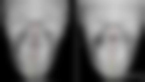 深圳正威和美妇产医院医疗美容科张文璐医生口碑评价如何?
