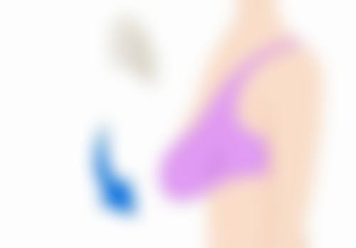 疤痕黄金修复期内的治疗方法