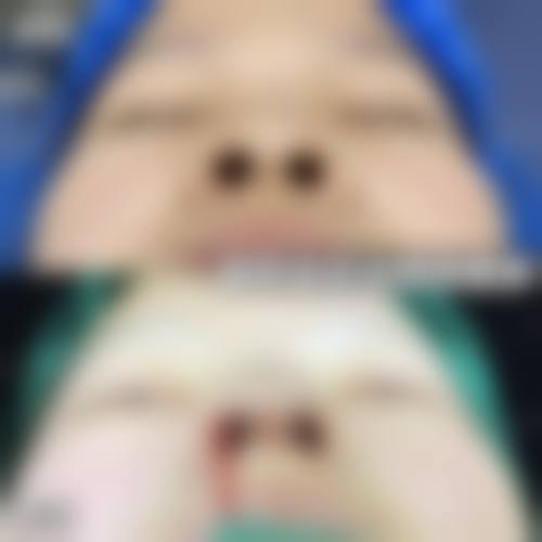 八、吴荣医生医美费用一览表