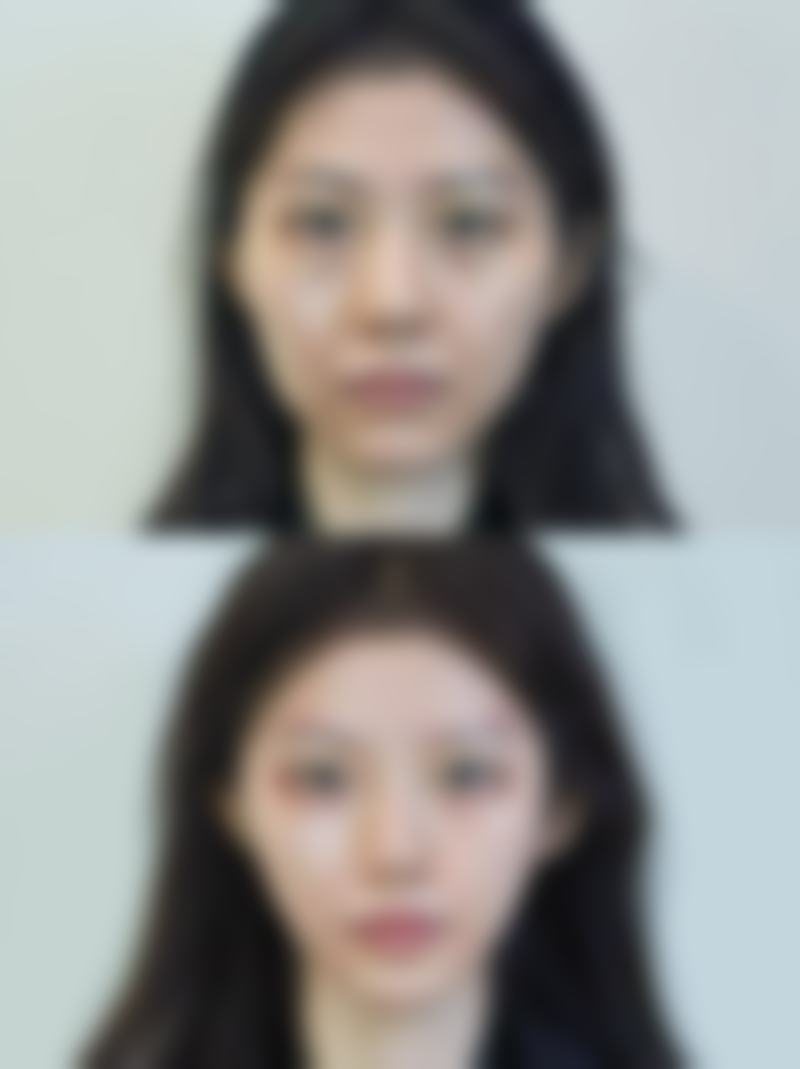 南宁梦想DREAM整形医院医院技术好不好?