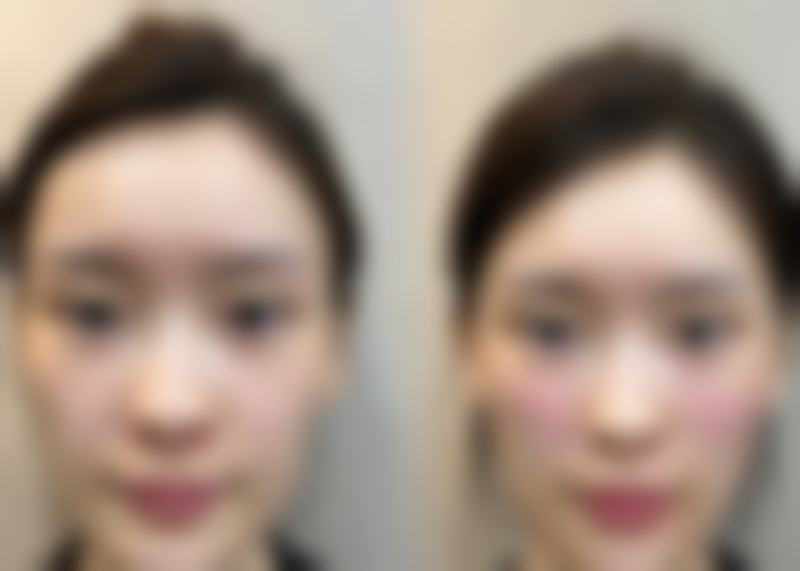 德阳法肤曼医疗美容诊所医院技术好不好？