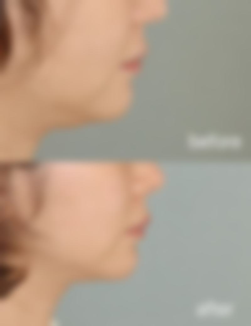 南宁梦想DREAM整形医院口碑如何?