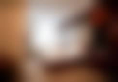 苏州美贝尔美容医院伊婉V玻尿酸1mL填充口碑如何?