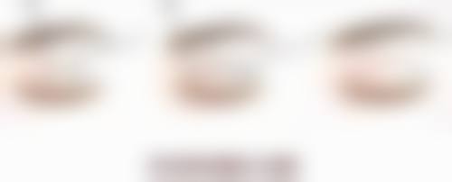 不同类型眼袋怎样去除较有效