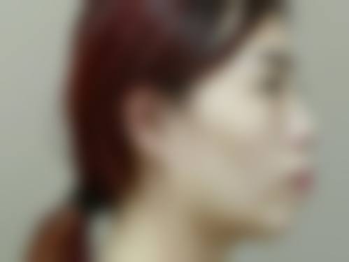 三、赵玲龙医生在口腔领域技术特长