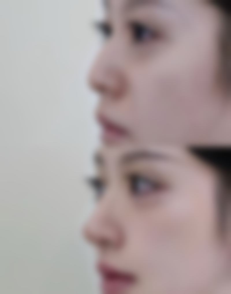 佛山南海黛美辰整形医院口碑如何?