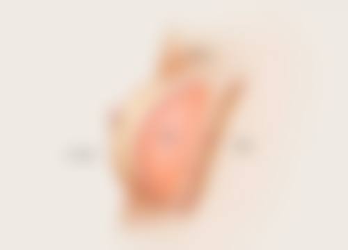 抽脂后会胖回去吗？原因、预防方法及手术花费一文为你揭秘