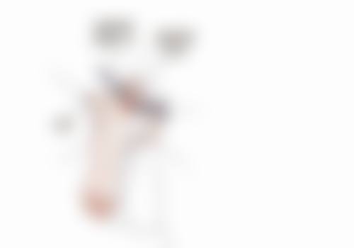 超声炮消除眼袋纹