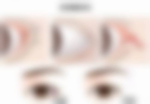 修复时的注意事项