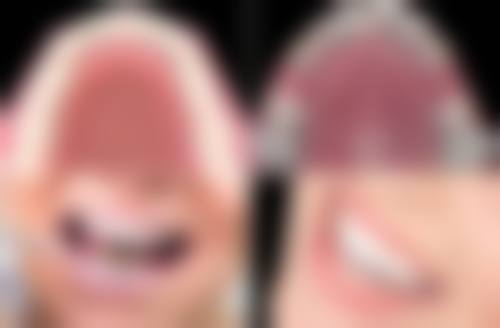 四、北辰时代口腔开展的项目以及特色项目