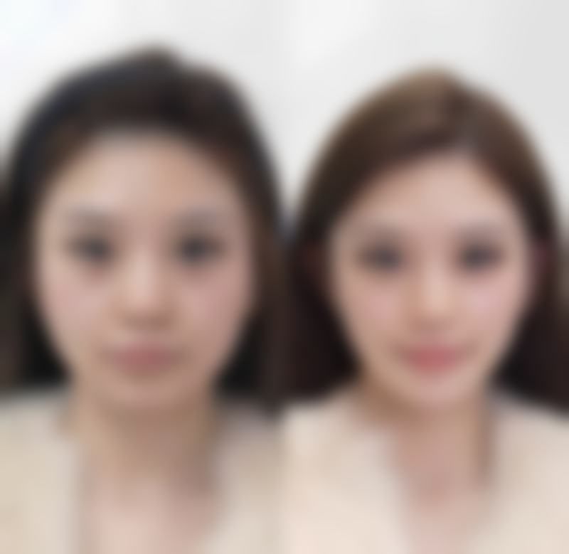 总结——长沙市瑞澜医疗美容医院怎么样?
