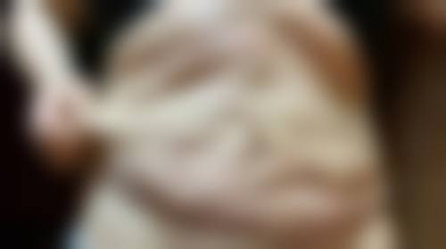 河池市第一人民医院医学美容科硬件设备精良!