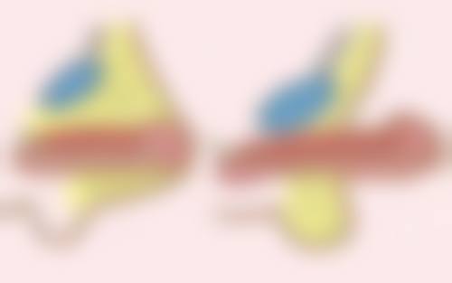 总结:敷面膜可以消除眼袋吗