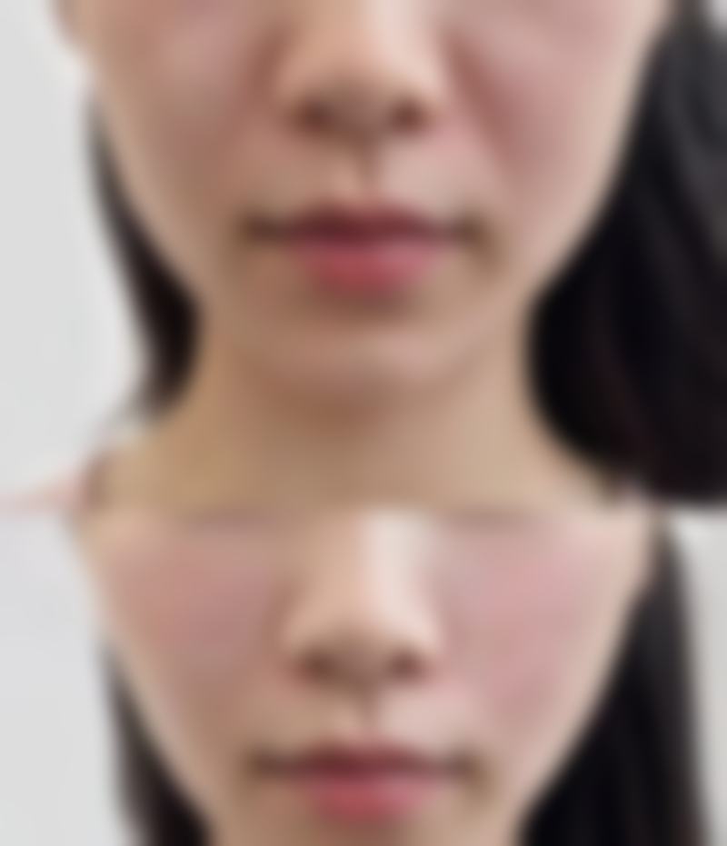 总结——东阳天鹅湖医疗美容医院怎么样?