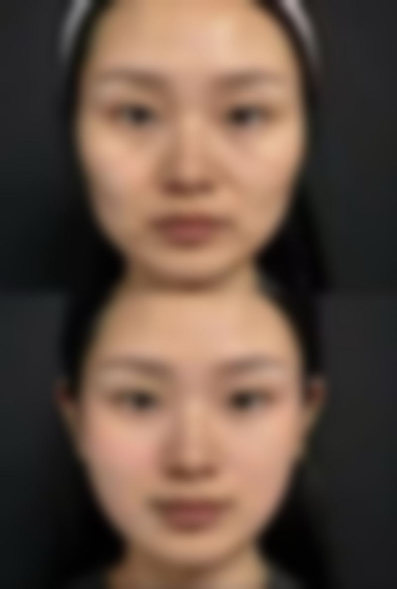 敷面膜对眼部护理的辅助作用