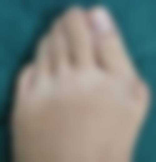 手臂和面部肌肉的差异