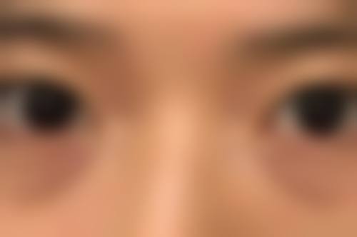 大理漾濞县人民医院整形美容科关志江医生口碑评价如何?