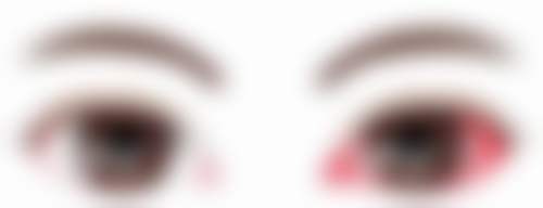 南阳市中心医院眼科