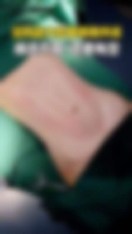 总结——上海丽保佳(保加)医疗美容门诊部Tony医生怎么样?