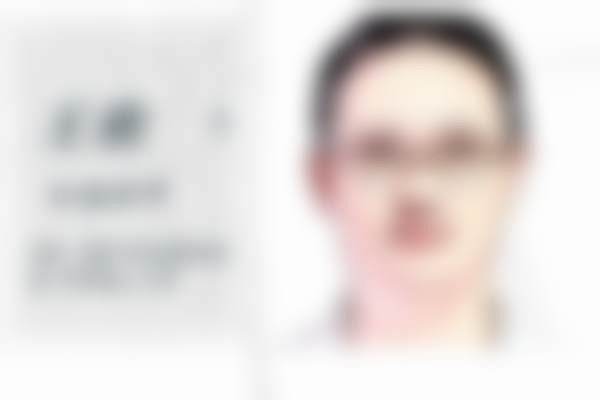 成都武侯华生铂悦美容医院王光斌和房林医生注射姣兰玻尿酸嘟嘟唇技术好不好?