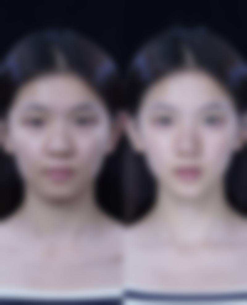 安丘市人民医院整形烧伤科医院技术好不好？